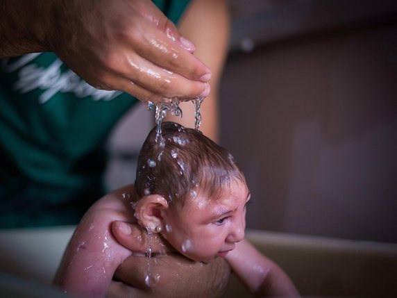 Le virus Zika peut provoquer des malformations visibles du crâne des nouveau-nés (archives). © KEYSTONE/EPA EFE/PERCIO CAMPOS