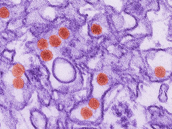 Un vermifuge utilisé pour traiter le ver solitaire serait capable de bloquer la multiplication du virus Zika, ici en rouge (archives). © KEYSTONE/AP Centers for Disease Control and Prevention/C.GOLDSMITH