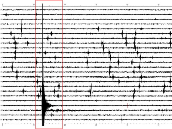 Un séisme de magnitude 4,6 a frappé la région de Linthal (GR) au début mars (Keystone archives/Observatoire Montseveier, Val Terbi). © KEYSTONE/Observatorium Montsevelier, Val/OGVT/GOVT