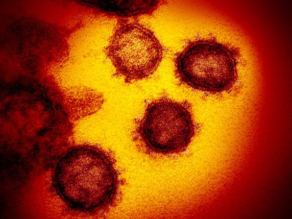 Les mutations génétiques du coronavirus sont traquées dans le monde entier par les chercheurs, qui séquencent le génome des virus qu'ils trouvent et les partagent sur une base de données internationale, GISAID, un trésor de plus de 30'000 séquences à ce jour (archives). © KEYSTONE/AP