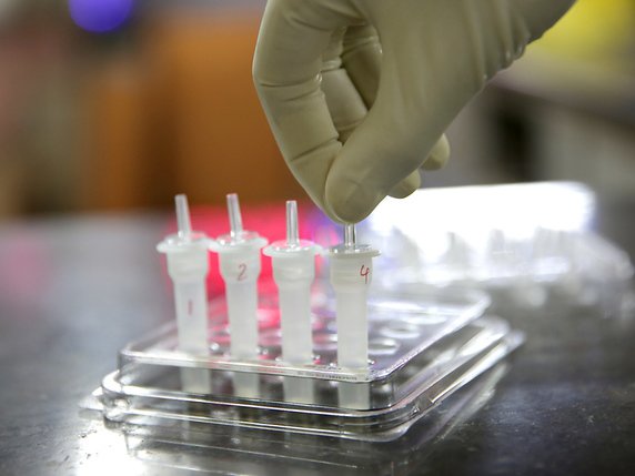 Les tests dits antigéniques donnent un résultat en 15 minutes (archives). © KEYSTONE/EPA/PIYAL ADHIKARY