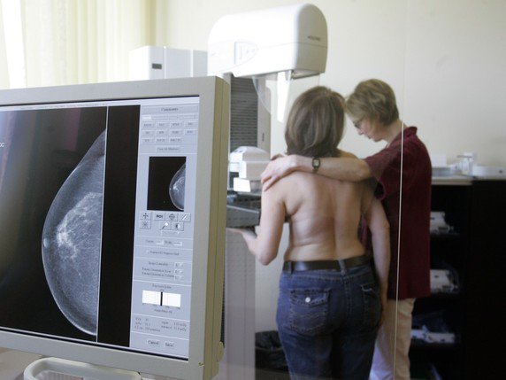 Jusqu'à 70% des femmes ayant eu un cancer du sein peuvent éviter la chimiothérapie (archives). © KEYSTONE/AP/FRANKA BRUNS