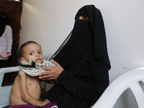 Selon une estimation de l'ONG Save the Children, quelque 85'000 enfants seraient morts de faim ou de maladie au Yémen entre avril 2015 et octobre 2018 (archives). © KEYSTONE/EPA/YAHYA ARHAB