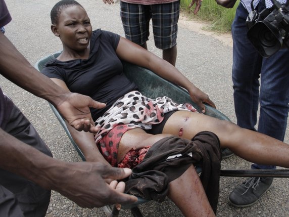 Zimbabwe: l'Association des médecins pour les droits de l'Homme (ZADHR) a annoncé avoir soigné au moins 172 personnes depuis lundi. Plus d'un tiers d'entre elles souffraient de graves blessures causées par des tirs à balles réelles. © KEYSTONE/EPA/AARON UFUMELI