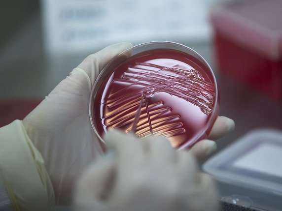 Selon l'Organisation mondiale de la santé (OMS), "la résistance aux antibiotiques constitue aujourd'hui l'une des plus graves menaces pesant sur la santé mondiale" (photo d'illustration). © KEYSTONE/FR171034 AP/BRANDEN CAMP