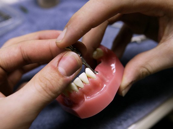 Le producteur de prothèses dentaires et de matériel chirurgical n'a pas laissé les analystes sur leur faim au premier semestre. (archive) © KEYSTONE/MARTIN RUETSCHI