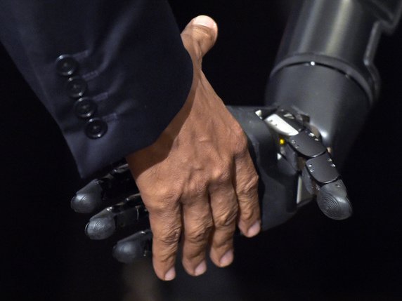 L'appareil, qui reproduit la sensation tactile, est conçu pour améliorer la qualité de vie des porteurs de prothèses et leur permettre de ressentir, par exemple, une poignée de main (image symbolique). © KEYSTONE/AP/SUSAN WALSH