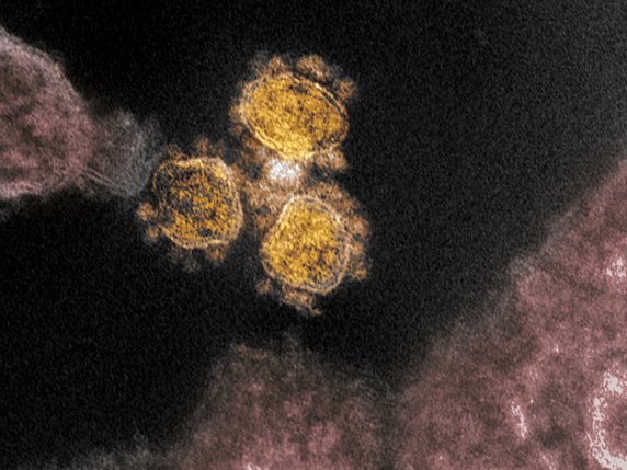 Cinq personnes ont été testées en Suisse par la maladie à coronavirus 2019. © KEYSTONE/EPA/NIAID- RML/NATIONAL INSTITUTES OF HEALTH HANDOUT