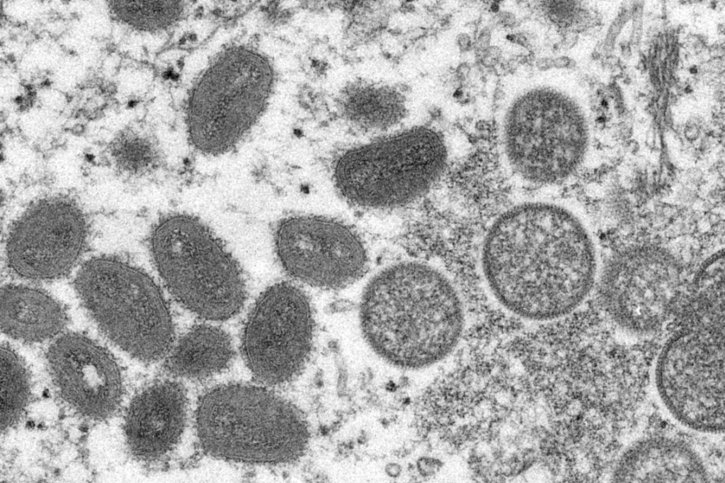 La variole du singe ou "orthopoxvirose simienne" est une maladie rare dont le pathogène peut être transmis de l'animal à l'homme et inversement. © KEYSTONE/AP