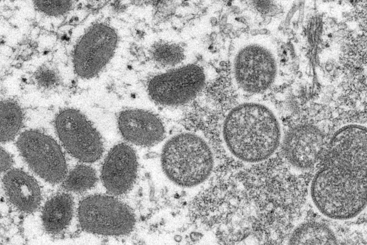 La variole du singe est une maladie infectieuse causée par virus qui se transmet de l'animal à l'humain, mais qui peut aussi se transmettre d'humain à humain (archives). © KEYSTONE/AP